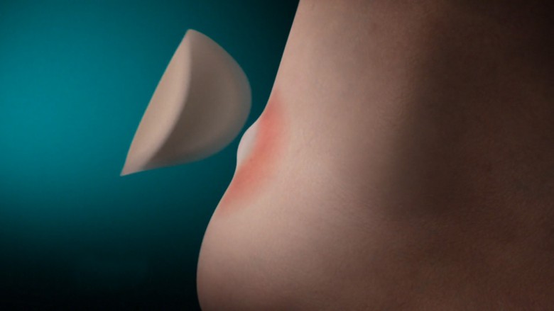 Hydrokolloid-teknologi